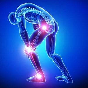 Sports injuries